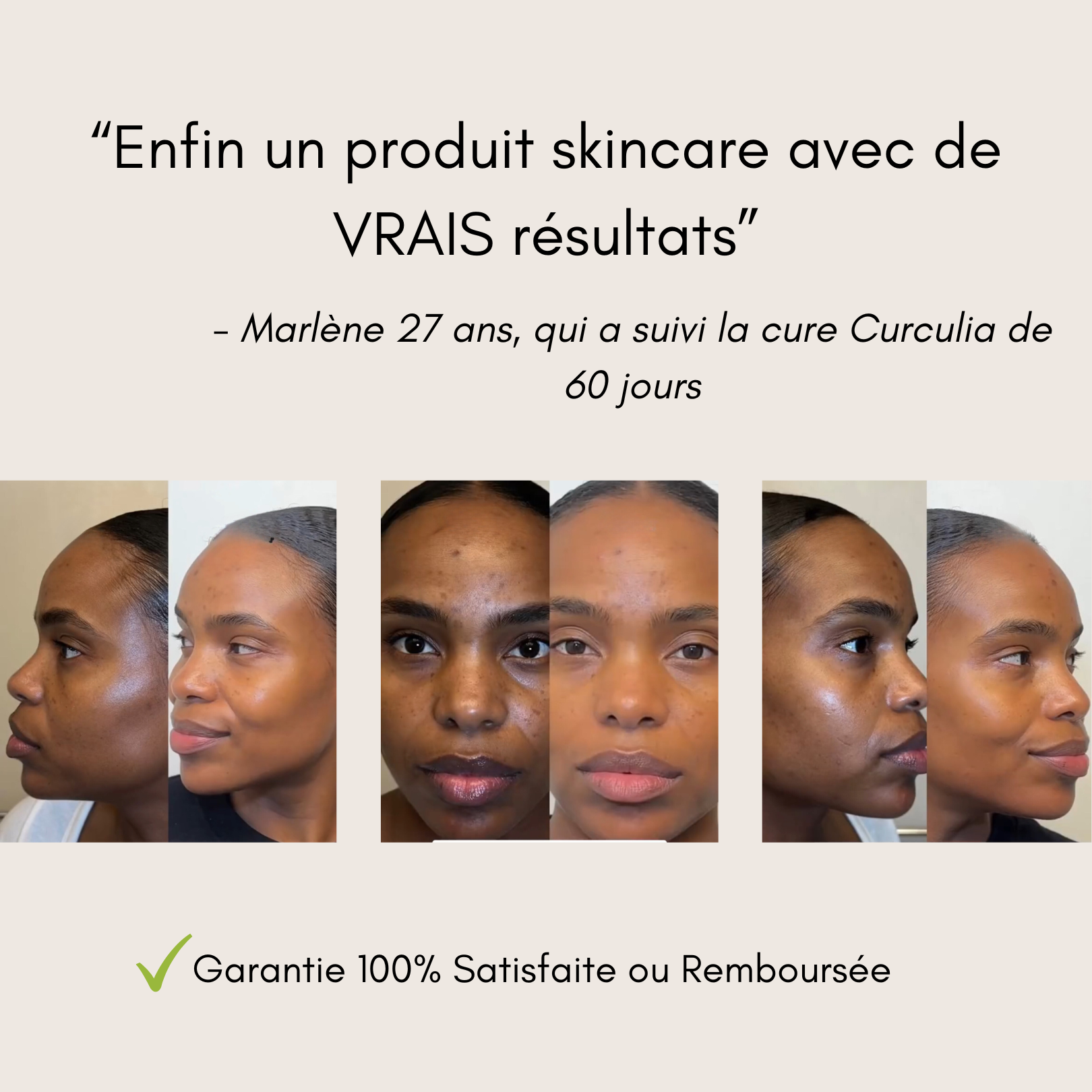 Pads Nettoyants au Curcuma 3 en 1
